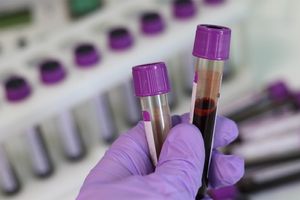 Дослідження біохімічного аналізу крові у тварин