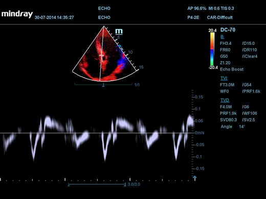 DC-70 — стаціонарна ультразвукова діагностична система з кольоровим доплером, Mindray DC-70 фото